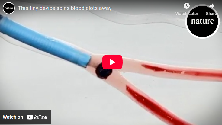Tiny device spins blood clots away Tiny device spins blood clots away